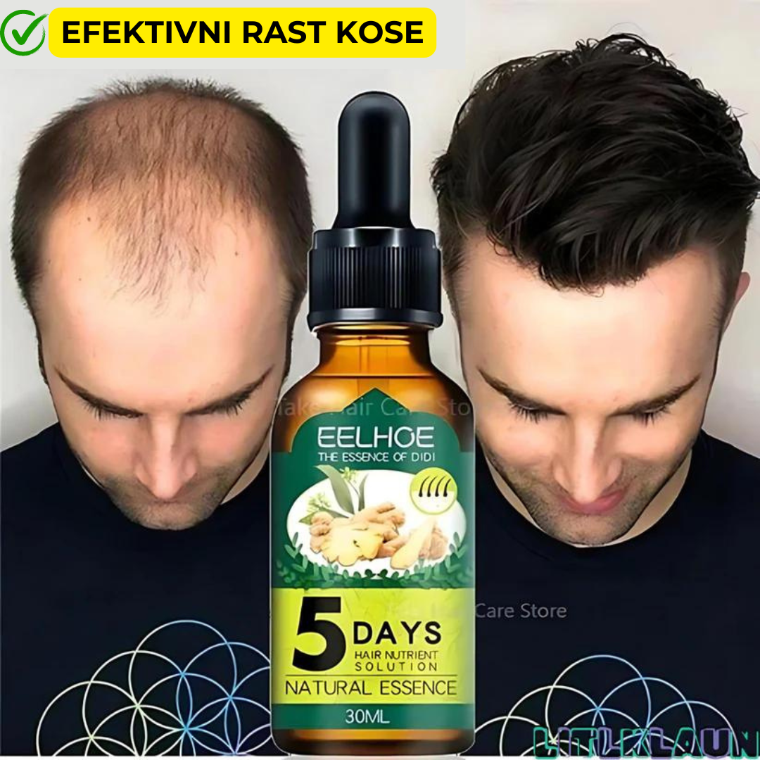 Ubrzajte rast kose za samo 5. dana